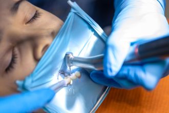 Anesthésie générale pour implants dentaires : astuces pour un rétablissement rapide